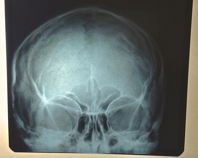What other blog brings you xrays of one of the protagonist's faces?